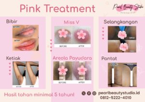 Pink Treatment Bekasi, Jakarta, Tangerang, Bekasi, Depok dan Bogor Murah